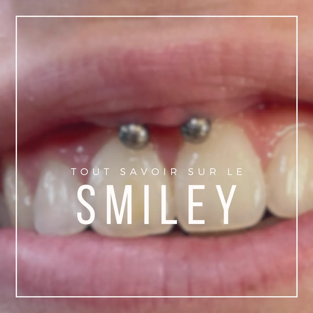 Tout savoir sur le piercing smiley