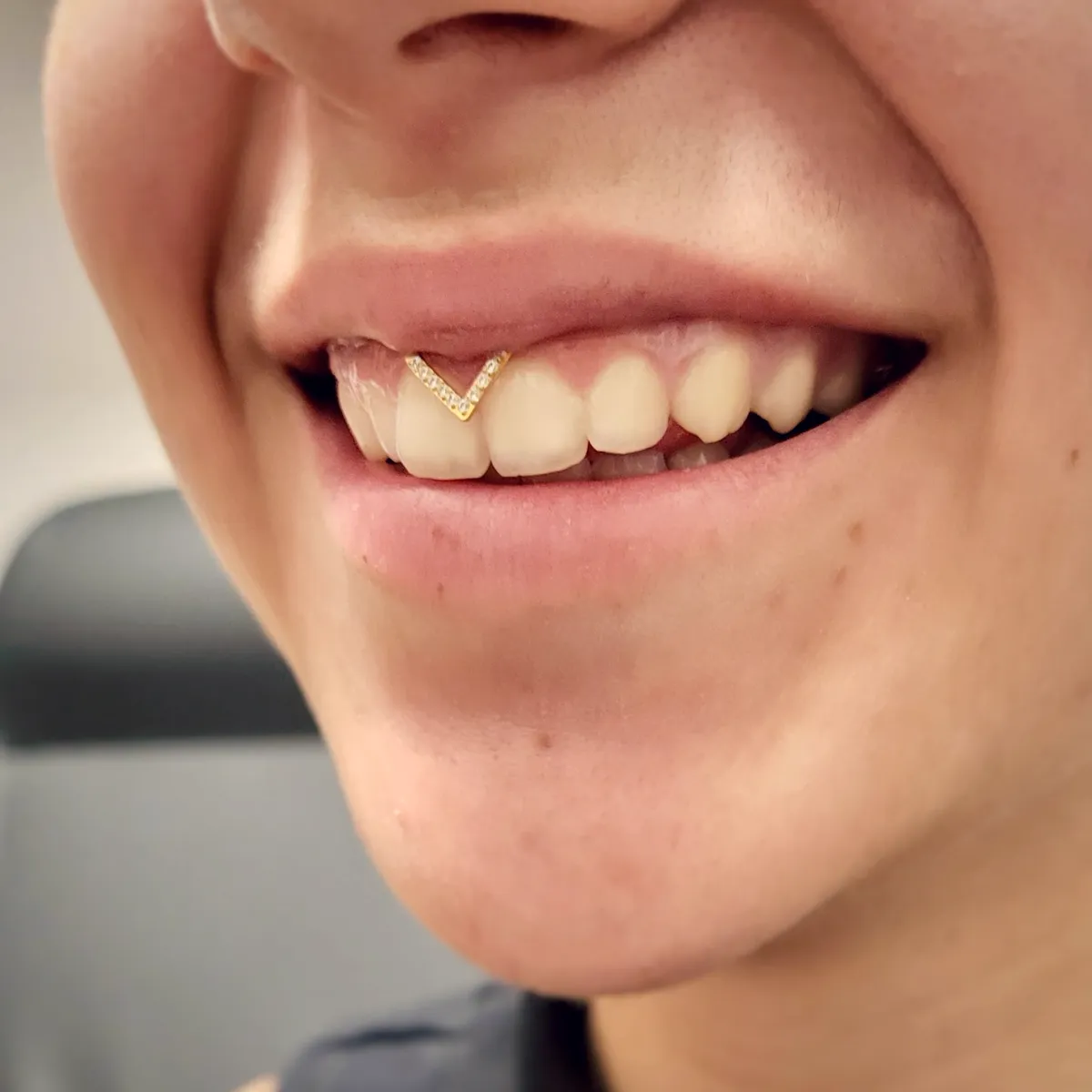 Tout savoir sur le piercing smiley, photo 10 sur 10