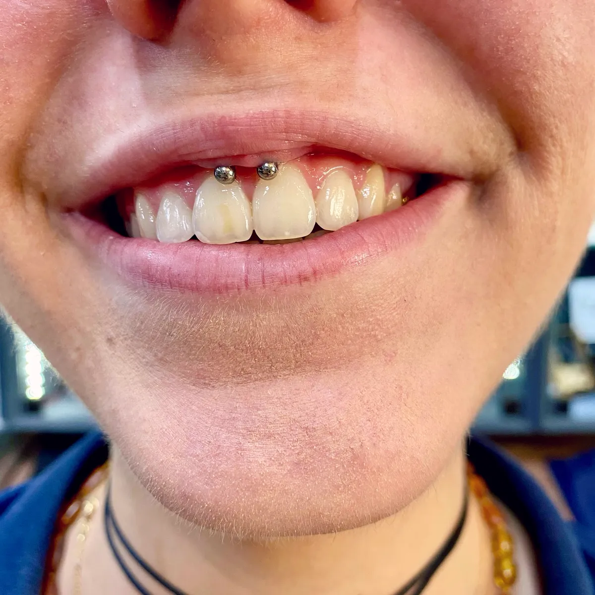 Tout savoir sur le piercing smiley, photo 2 sur 10