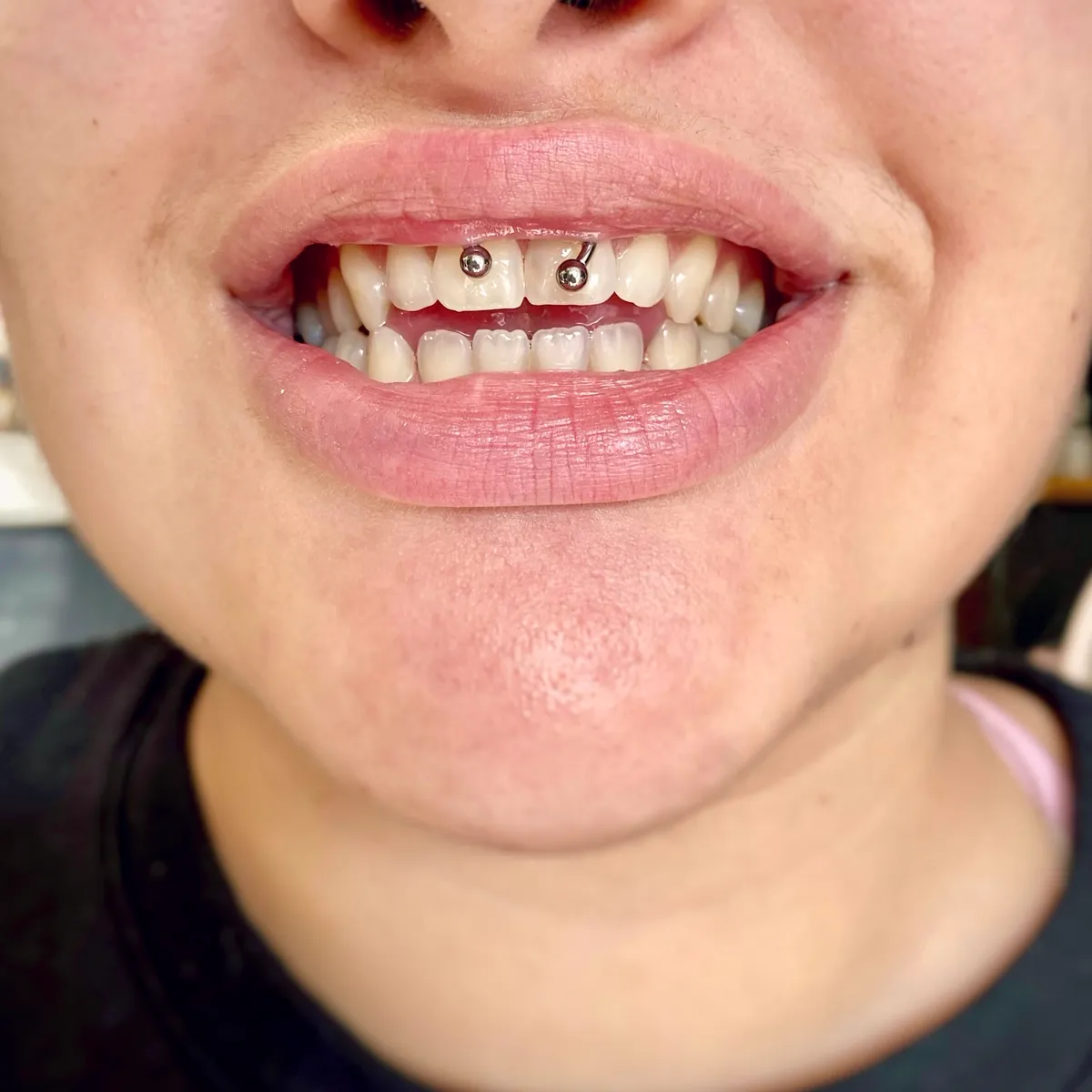 Tout savoir sur le piercing smiley, photo 3 sur 10