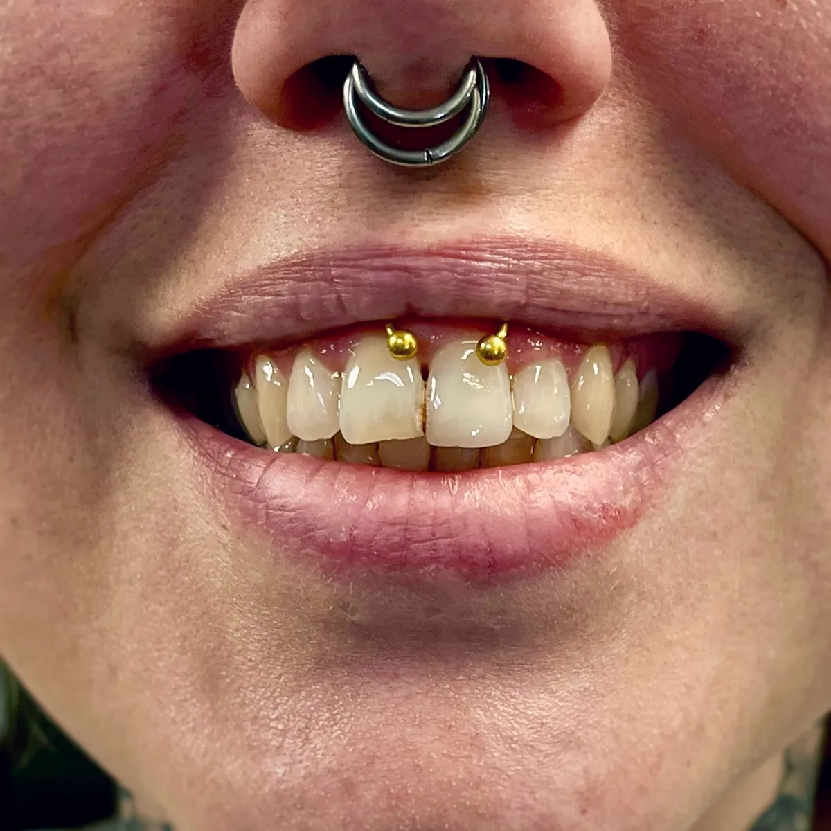 Tout savoir sur le piercing smiley, photo 4 sur 10