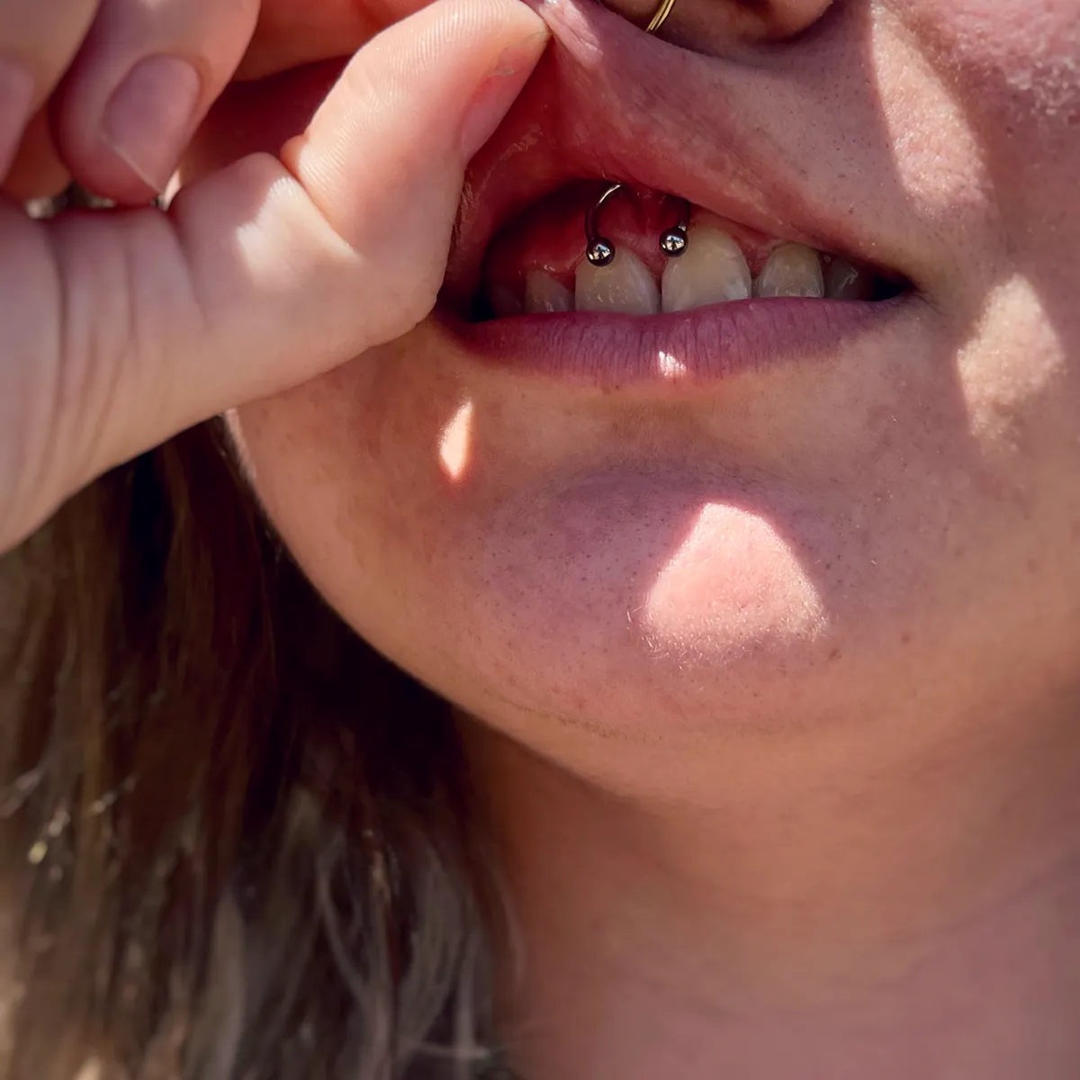 Tout savoir sur le piercing smiley, photo 6 sur 10