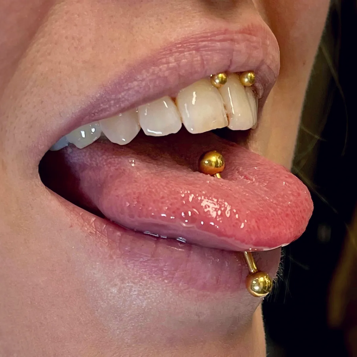 Tout savoir sur le piercing smiley, photo 7 sur 10