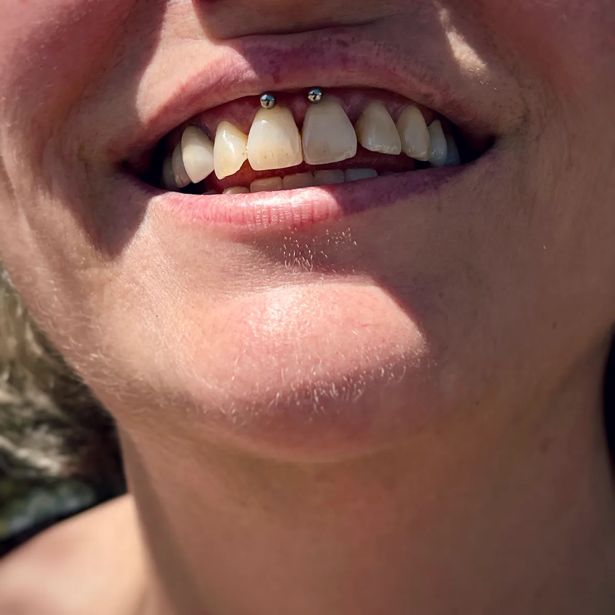 Tout savoir sur le piercing smiley, photo 8 sur 10