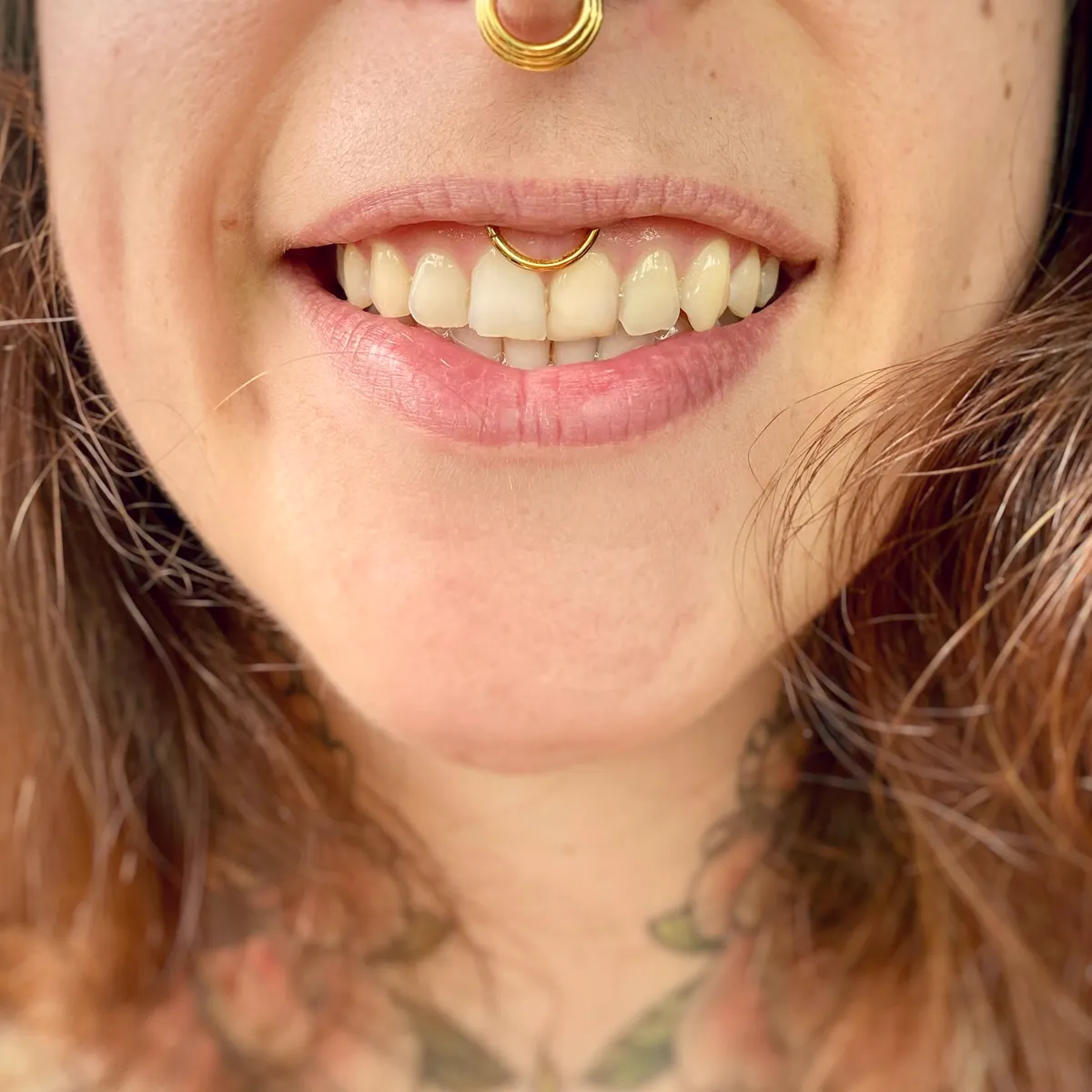 Tout savoir sur le piercing smiley, photo 9 sur 10