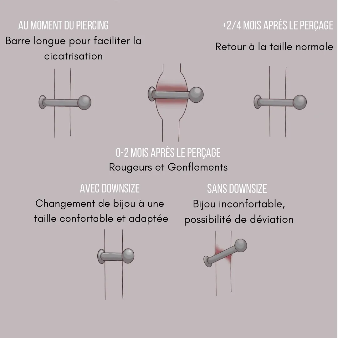 Tout savoir sur le downsize, photo 2 sur 3