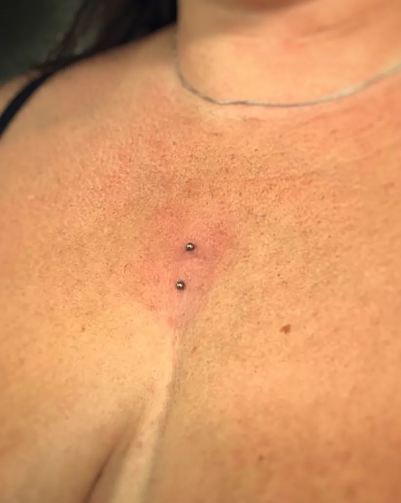 Tout savoir sur le piercing surface, photo 2 sur 9
