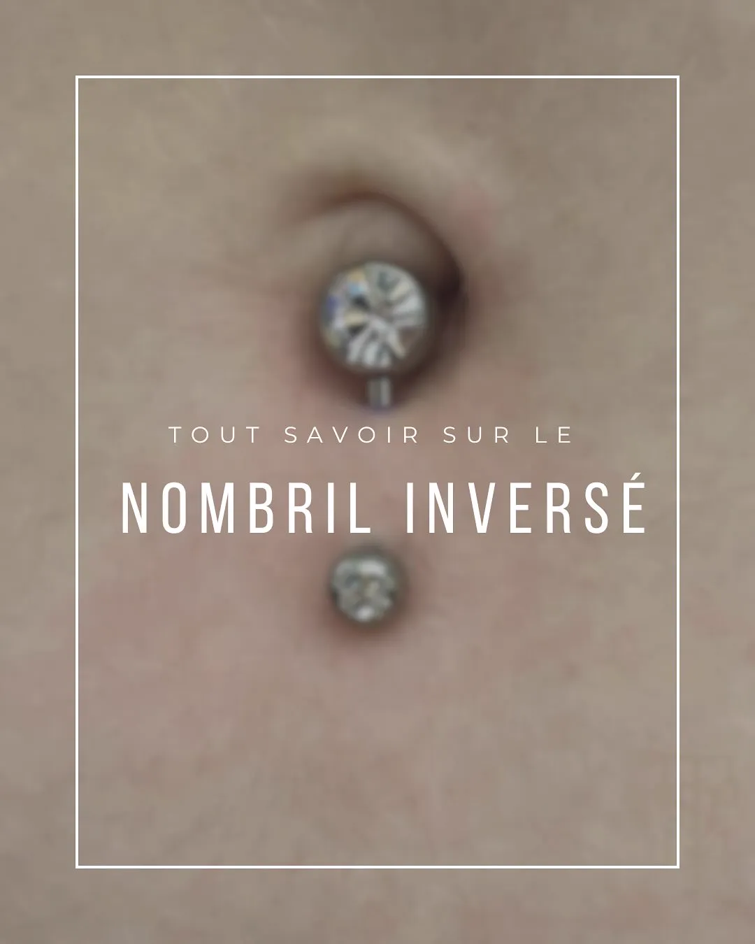 Tout savoir sur le nombril inversé