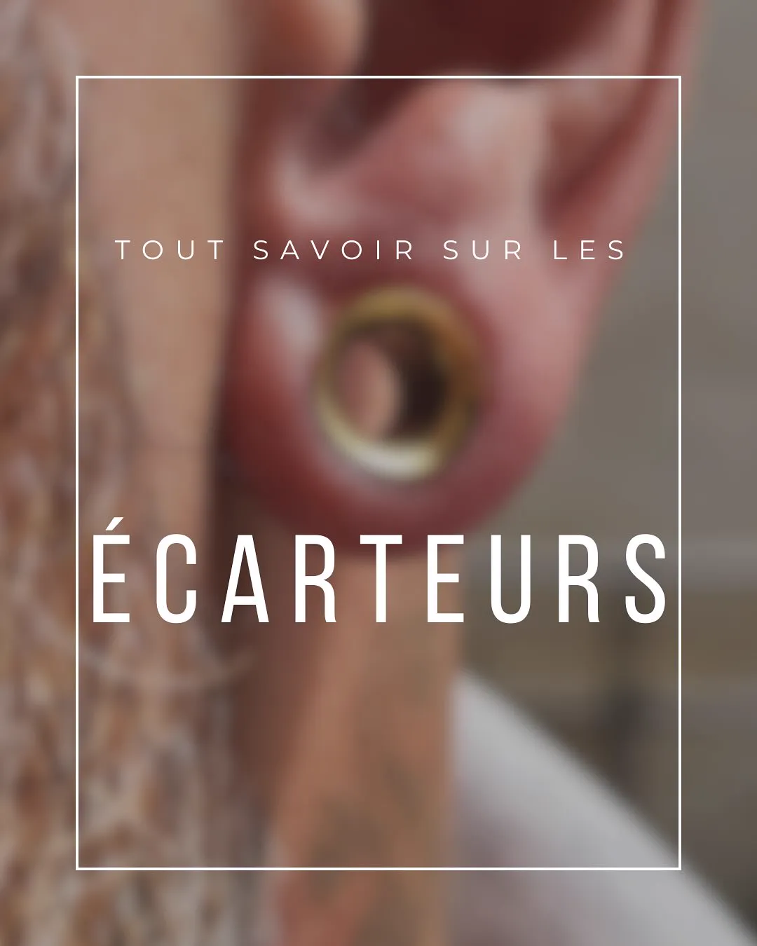 Tout savoir sur le stretching (écarteurs)