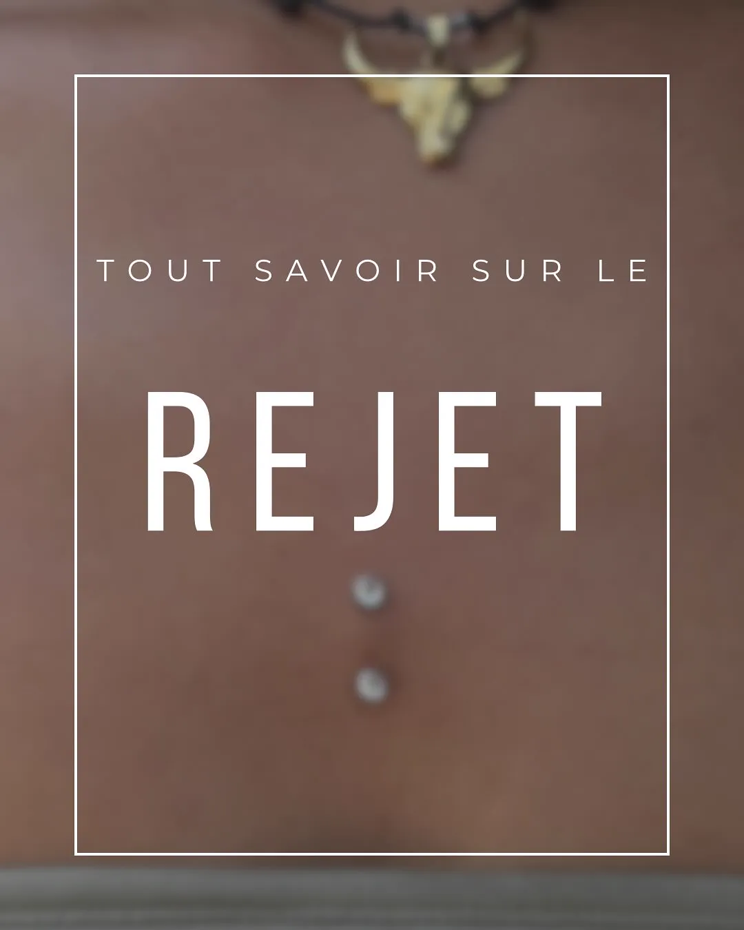 Tout savoir sur le rejet