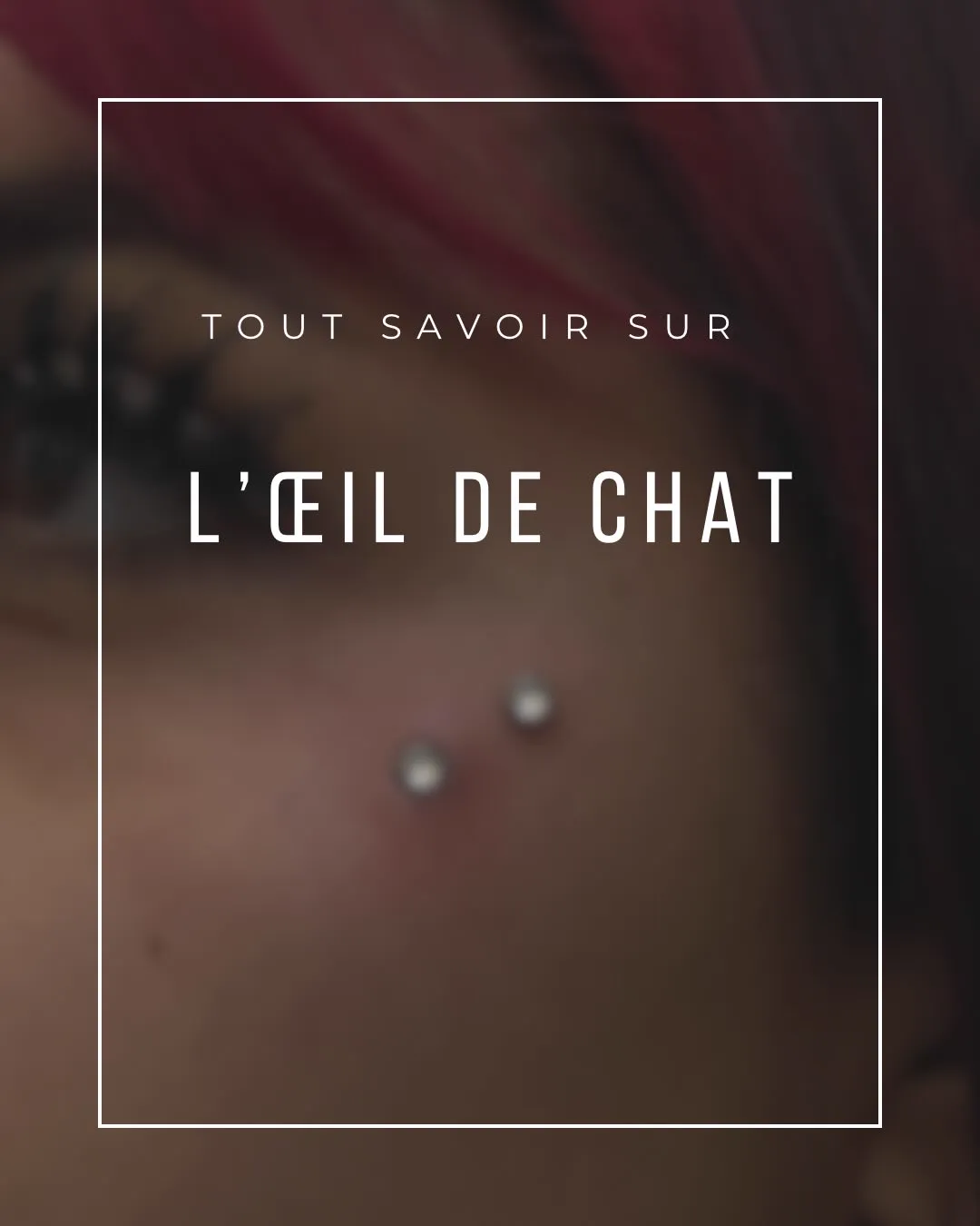 Tout savoir sur l'œil de chat