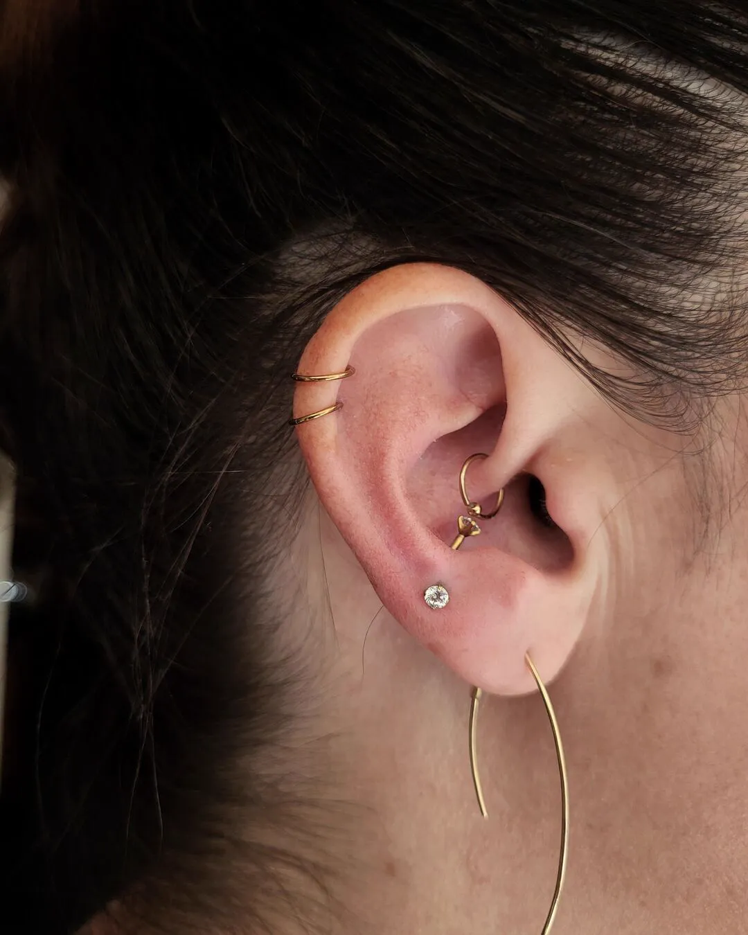 Tout savoir sur l'anti-tragus, photo 2 sur 6