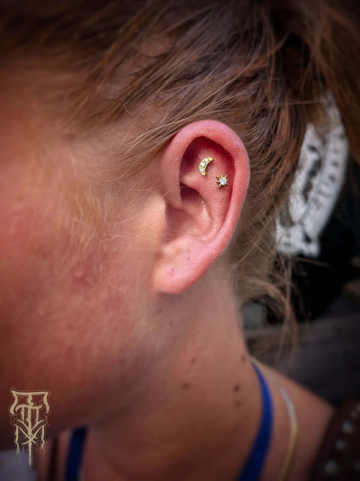 Double Flat — du fraîchement réalisé au résultat cicatrisé, photo 1 sur 4