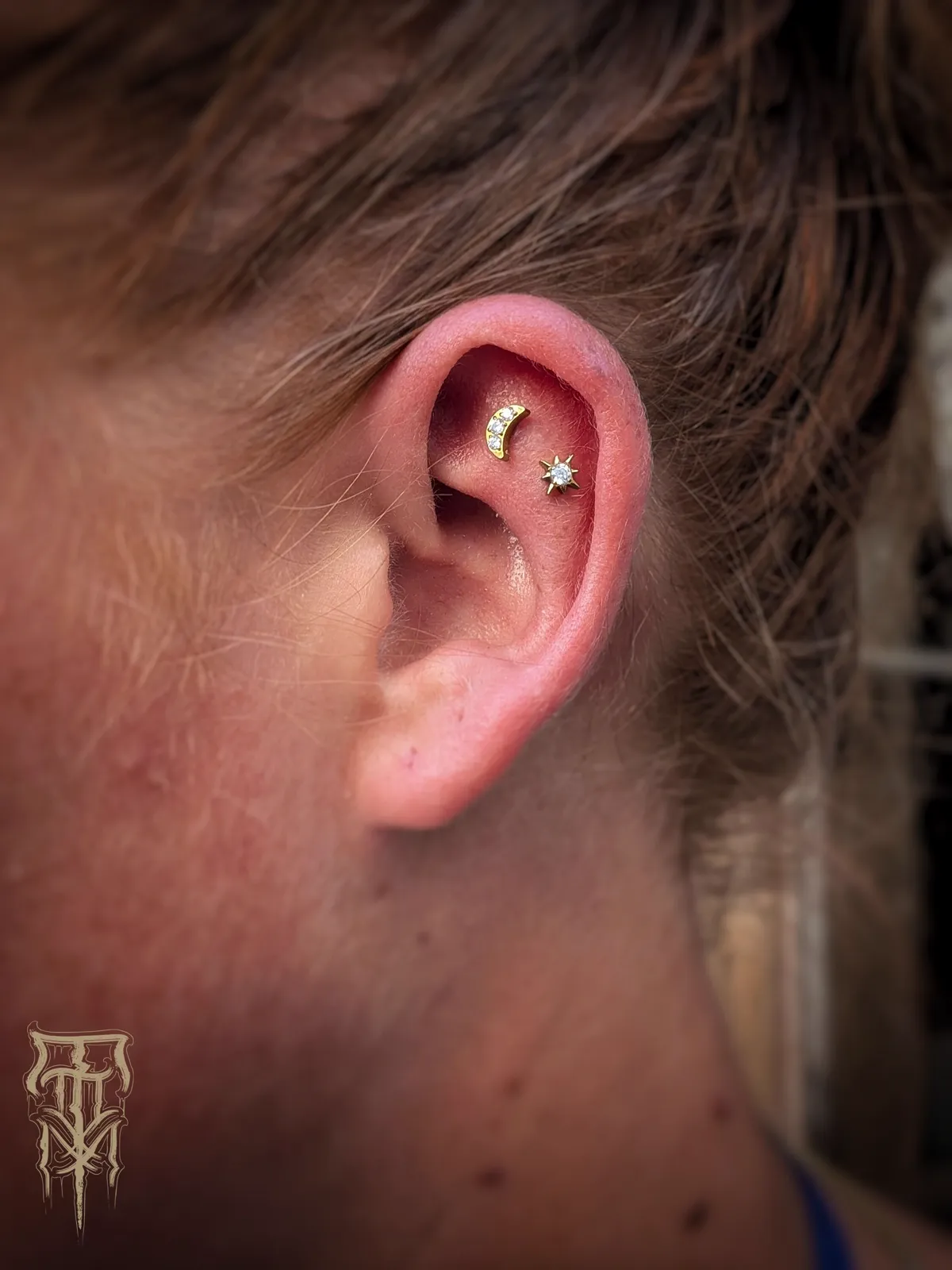 Double Flat — du fraîchement réalisé au résultat cicatrisé, photo 3 sur 4